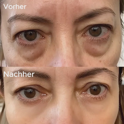 AugenFrisch — Rotlicht + EMS gegen Augenringe und Tränensäcke.